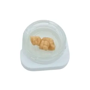 Photo of Chipped Tooth