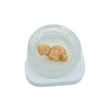 Photo of Chipped Tooth