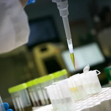 Photo of Microbiological Contaminants Screen